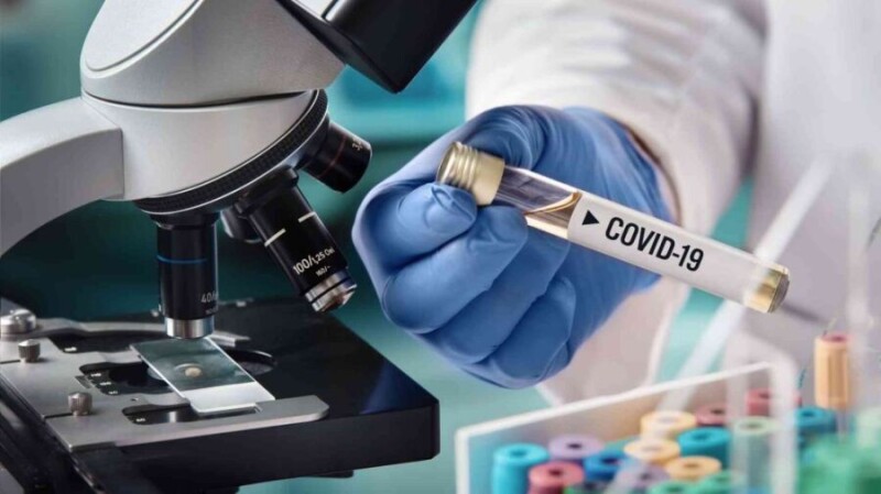 pruebas-rapidas-para-enfrentar-el-coronavirus-covid-19-1024x576